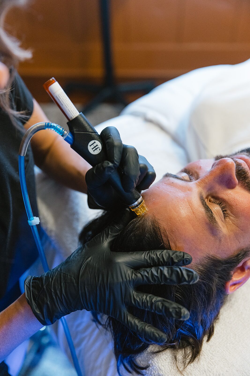Scalp Treatment & Hair Restoration